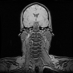 MRI p0021